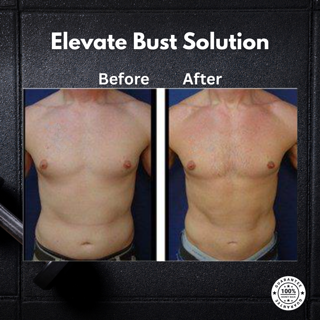 Elevate Bust Solution™