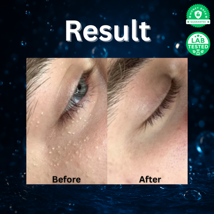 Milia Cleansing Serum™